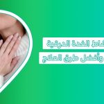 أعراض الغدة الدرقية عند النساء أعراض خمول الغدة الدرقية عند النساء تحليل tsh المعدل الطبيعي للنساء علاج خمول الغدة الدرقية للنساء عوارض الغدة عند النساء