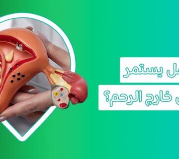 أعراض الحمل خارج الرحم الاعراض الاولى للحمل خارج الرحم أسباب الحمل خارج الرحم أعراض الحمل خارج الرحم بدون نزيف