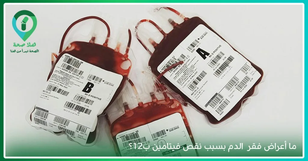 هل فقدان الوزن من أعراض نقص فيتامين ب١٢؟ 2 اعراض فقر الدم بسبب نقص فيتامين ب12-أعراض نقص فيتامين ب12 النفسية
