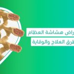 اعراض هشاشة العظام علاج هشاشة العظام أدوية هشاشة العظام أفضل حبوب هشاشة العظام