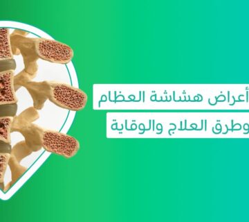 اعراض هشاشة العظام علاج هشاشة العظام أدوية هشاشة العظام أفضل حبوب هشاشة العظام