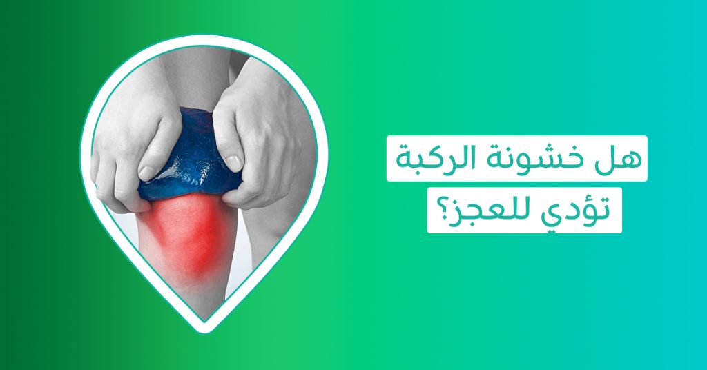 هل خشونة الركبة تُعيق حياتك الطبيعية؟ اكتشف الأسباب والأعراض وخيارات العلاج الفعالة - اعراض خشونة الركبة - علاج خشونة الركبة - اسباب خشونة الركبة - أعراض خشونة الركبة المبكرة - أسباب خشونة الركبة عند النساء - درجات خشونة الركبة - الإبرة الزيتية للركبة - تجربتي مع حقن البلازما للركبة - شكل خشونة الركبة بالصور - تجربتي مع حب الرشاد لخشونة الركبة - ادوية علاج الخشونة - حقن السائل الزلالى للركبة - حقن خشونة الركبة بالبلازما - الوقاية من خشونة المفاصل - حب الرشاد لعلاج الخشونة