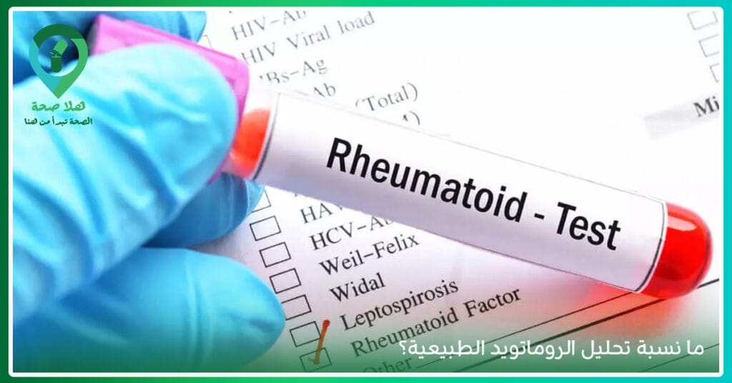 اسباب الروماتويد لا يخبرك بها الأطباء.. اكتشفها الآن قبل فوات الأوان! 3 نسبة تحليل الروماتويد الطبيعية-علاج الروماتويد نهائيا-هل الروماتويد خطير-نصائح لمرضى الروماتويد