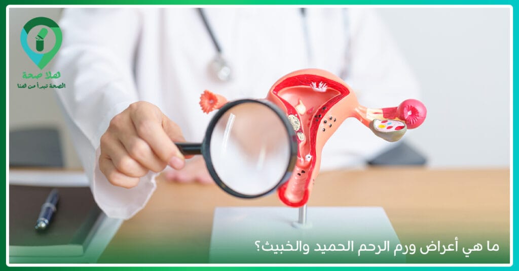 اعراض سرطان عنق الرحم: إشارات لا تهمليها قد تنقذ حياتك 2 أعراض سرطان عنق الرحم للمتزوجة-كيف اكتشفتي سرطان عنق الرحم-أعراض سرطان عنق الرحم الحميد-نسبة الشفاء من سرطان عنق الرحم